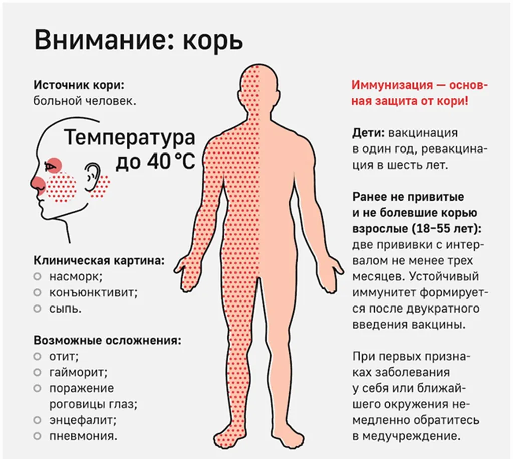 Внимание Корь!